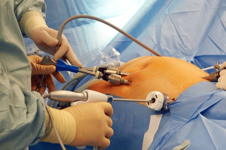 Bariatric Surgeon in New Delhi | Weight Loss Treatment in New Delhi – Dr. Jayadatt Pawar