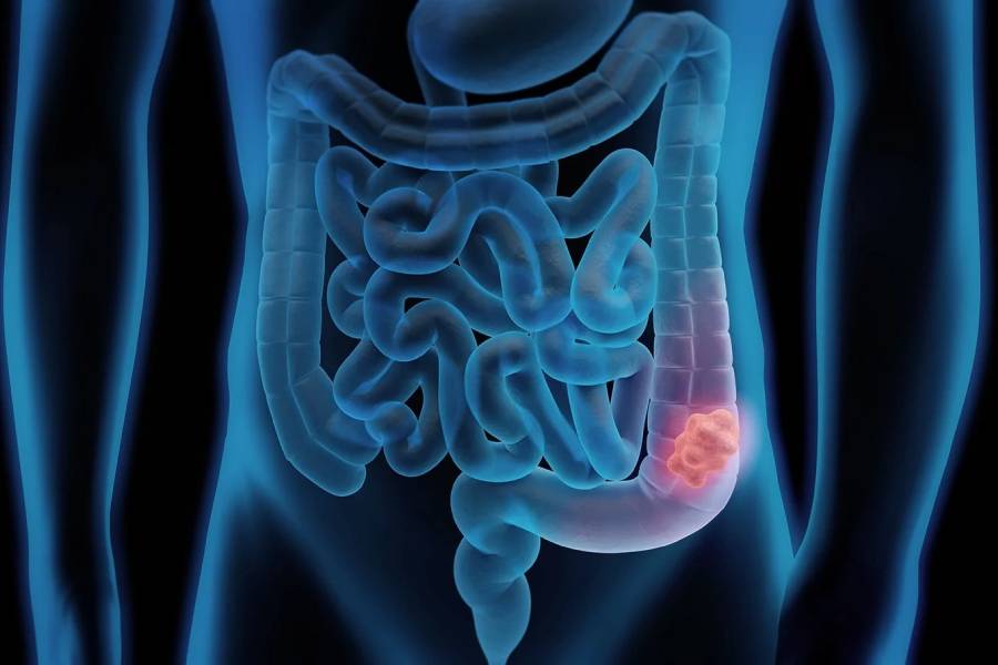 Best Colorectal Surgeon in New Delhi | Laparoscopic & Robotic Colorectal Surgery | Dr. Jayadatt Pawar